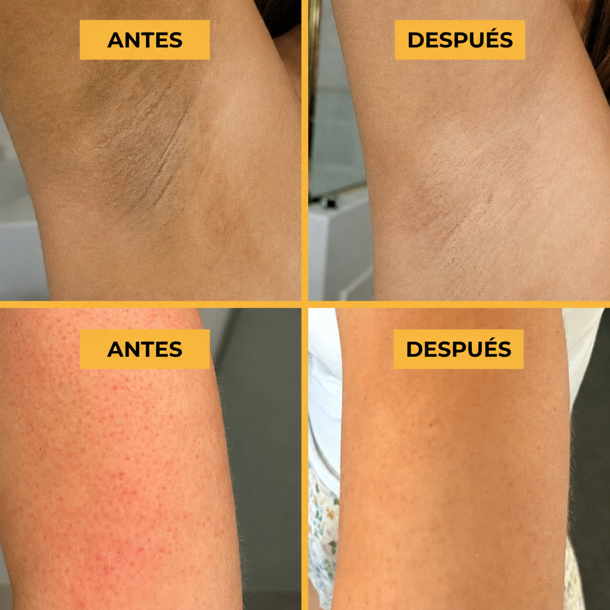 Antes y despues