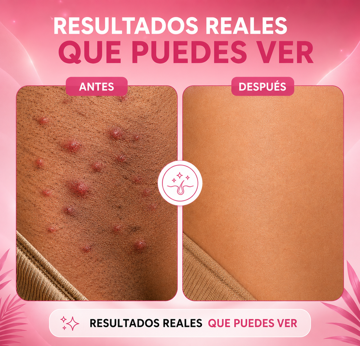 Resultados reales antes y después