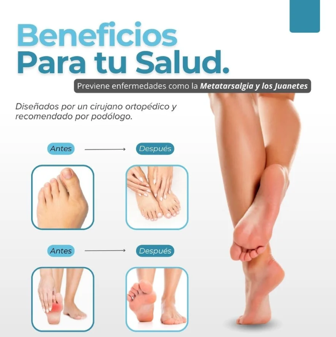 Beneficios para tu salud — previene juanetes y metatarsalgia. Antes y después